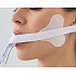 elastoFIXAL Set - lepící páska/set pro endotracheální trubici, nesterilní, 1 ks 